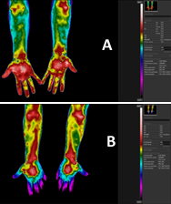 crps 1.jpg